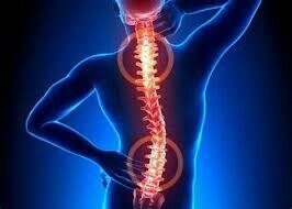 強直性脊椎炎 | Ankylosing Spondylitis
