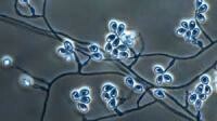 抗真菌 | Anti Fungal