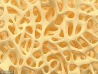 骨骼密度強度 | Bone Density &amp; Strength (Flexi)