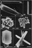 草酸鈣結晶 | Calcium Oxalate Crystal