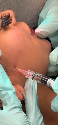 Polynucleotide Injection: A Revolutionary Treatment for Skin Rejuvenation