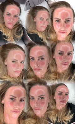 Bespoke Skin Treatments APPOINTMENTS - Oldham 