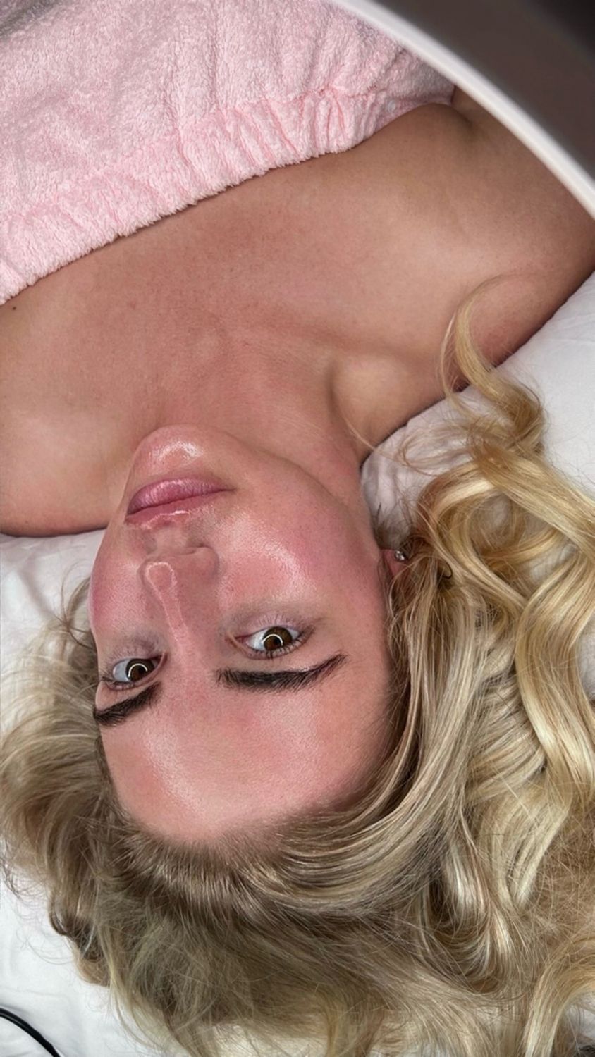 Advanced Chemical Peel Training