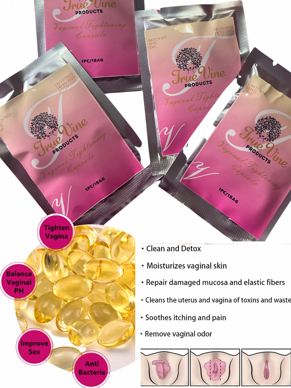 Tightening Capsules