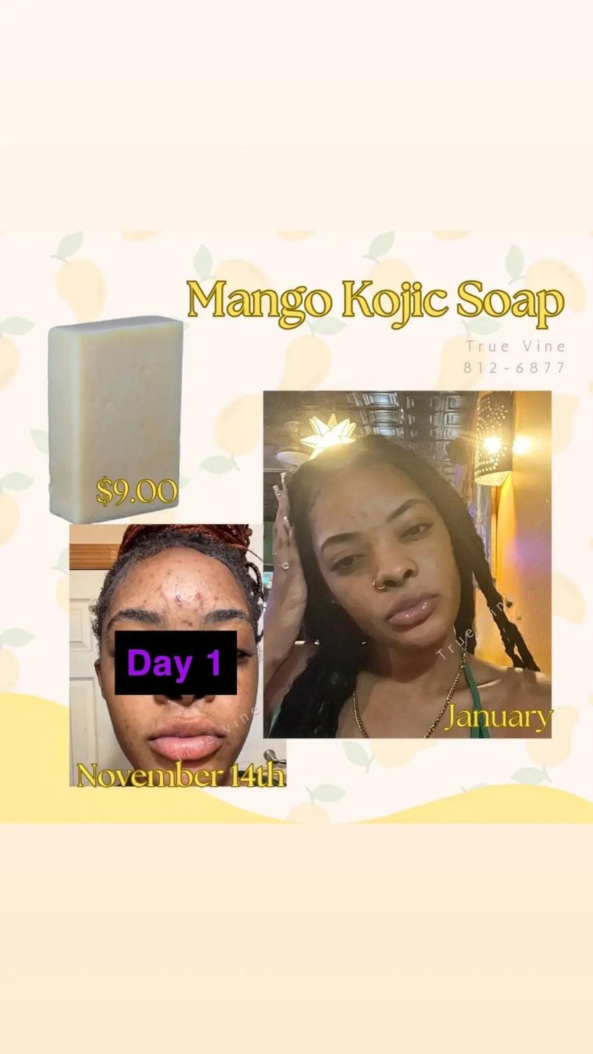 Mango Kojic