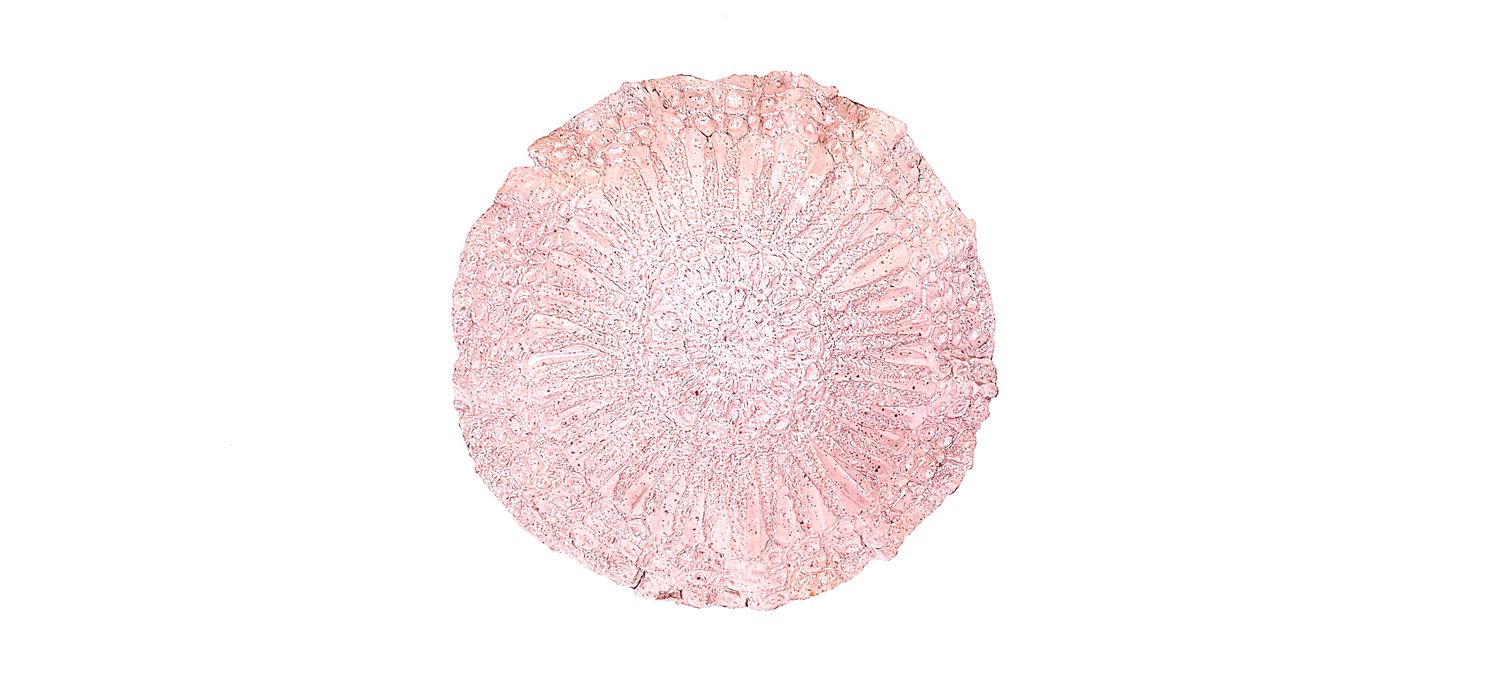 Jelly Fish 11&quot; x 11&quot; 