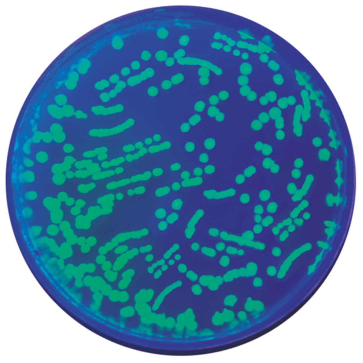 Transformation of E. coli with Green Fluorescent Protein (GFP)