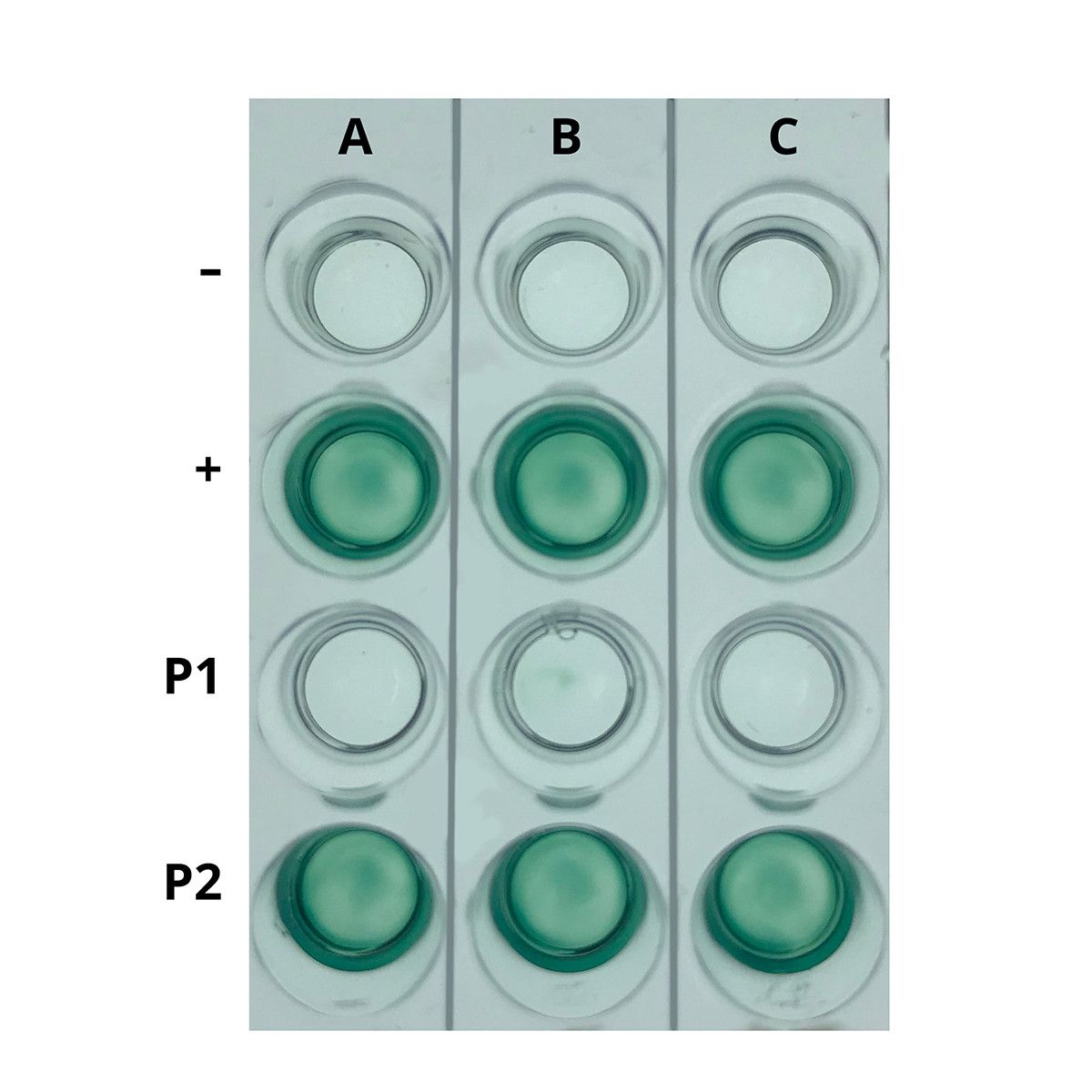 AIDS Kit I: Simulation of HIV Detection by ELISA