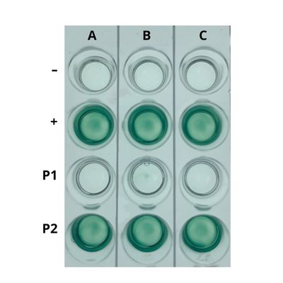 AIDS Kit I: Simulation of HIV Detection by ELISA