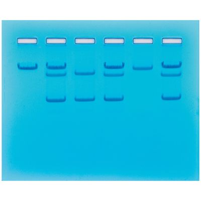 Sickle Cell Gene Detection (DNA-based)