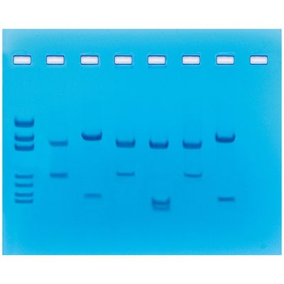 DNA Fingerprinting Using Restriction Enzymes