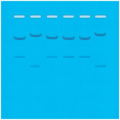 DNA Fingerprinting by Restriction Enzyme Patterns