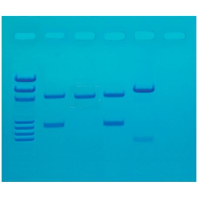 DNA Fingerprinting by PCR Amplification