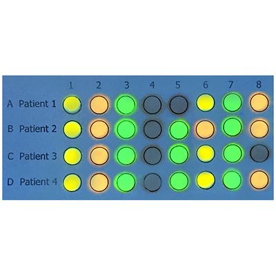 DNA/RNA Microarrays
