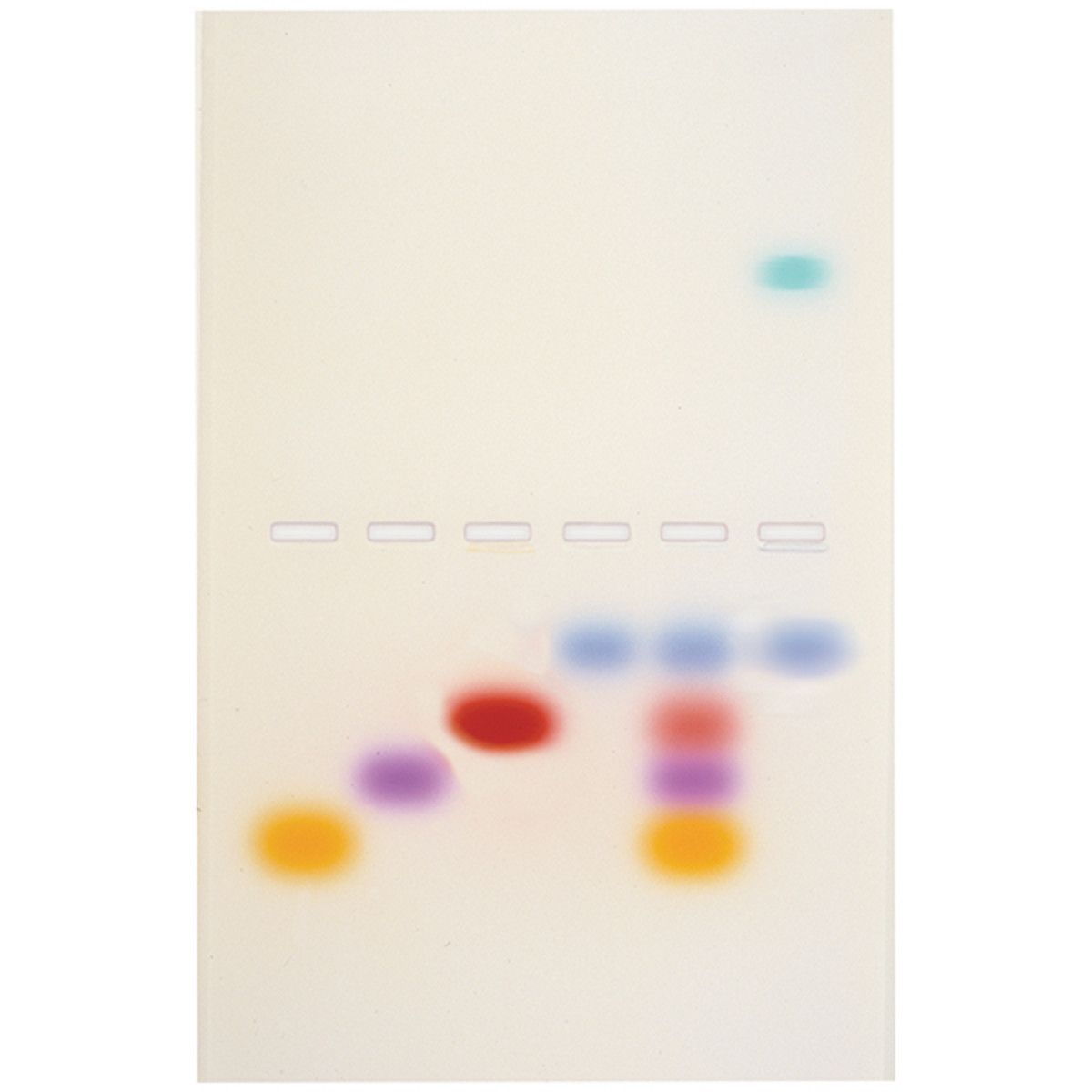 Principles and Practice of Agarose Gel Electrophoresis