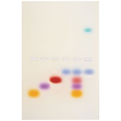 Principles and Practice of Agarose Gel Electrophoresis