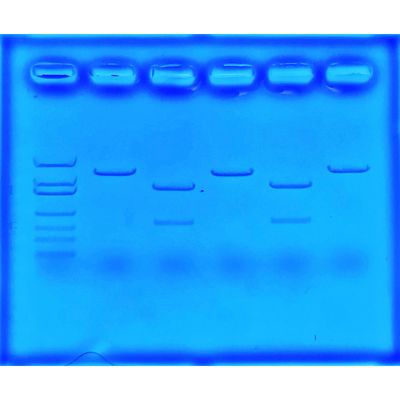 Using CRISPR To Treat Cystic Fibrosis