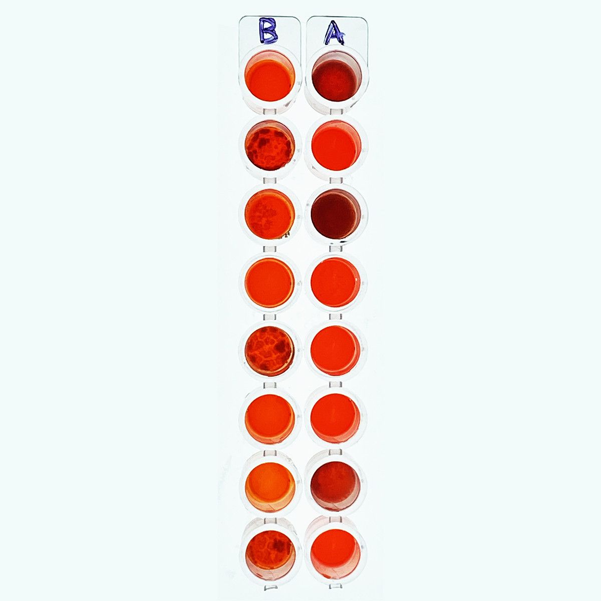 Blood Typing