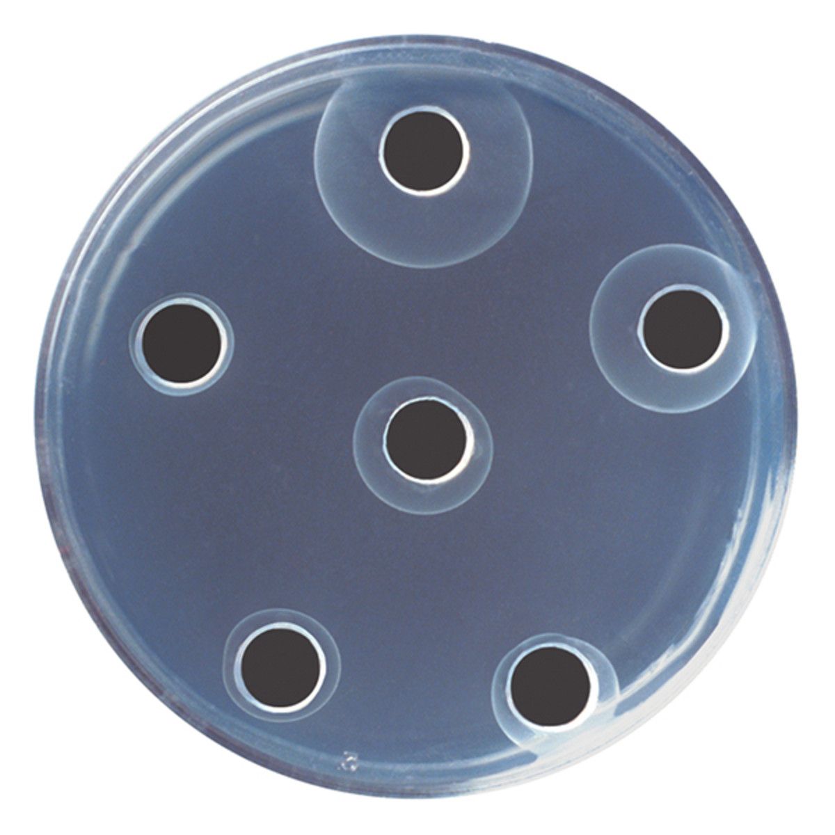 Radial Immunodiffusion