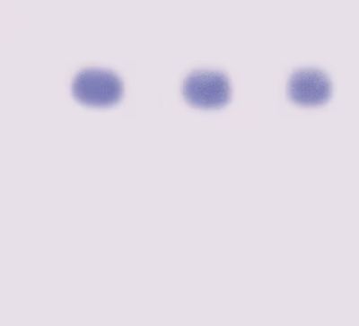 AIDS Kit II: Simulation of HIV Detection by Western Blot