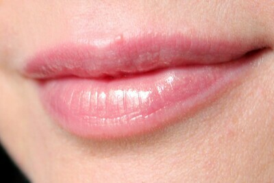 lip care
