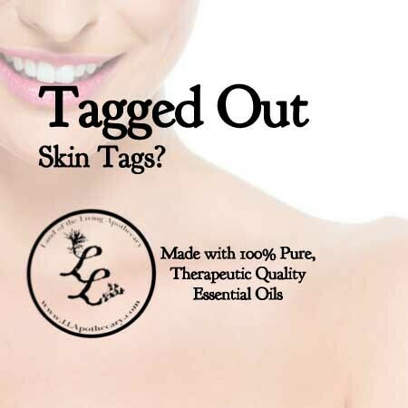 Tagged Out | Skin Tags?