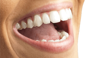 Internal application lips &amp; mouth