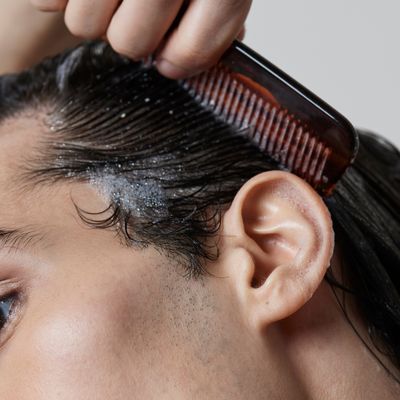 Scalp conditions