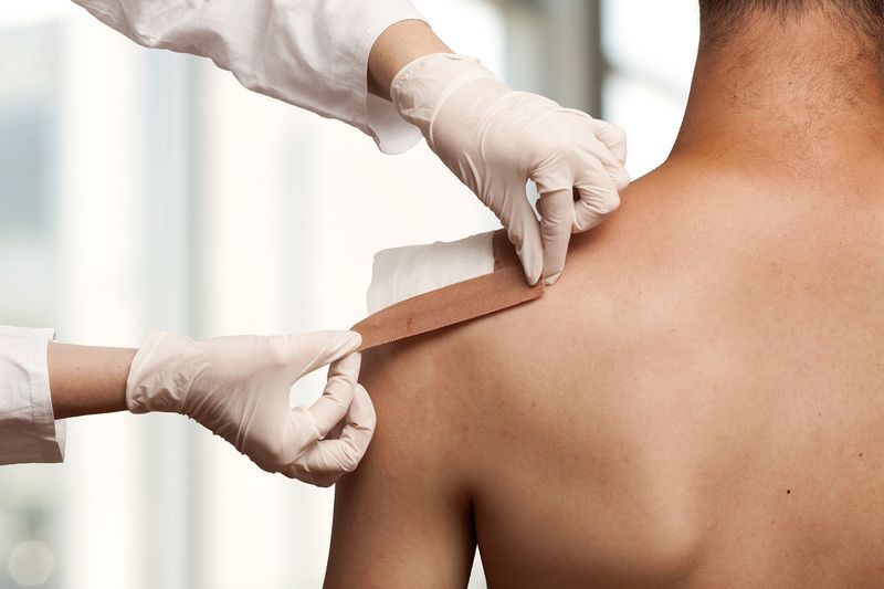 General Wound treatment