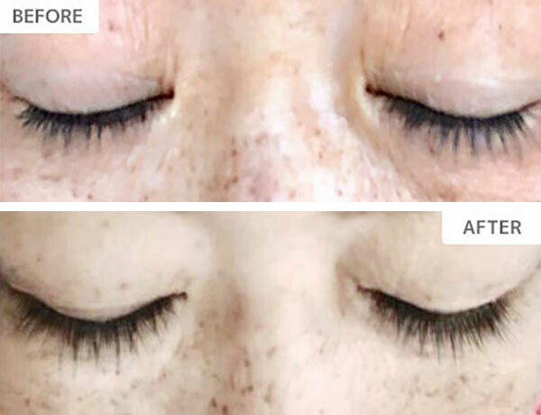 XXLashes まつげ美容液3ml