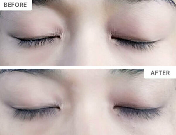 XXLashes まつげ美容液3ml