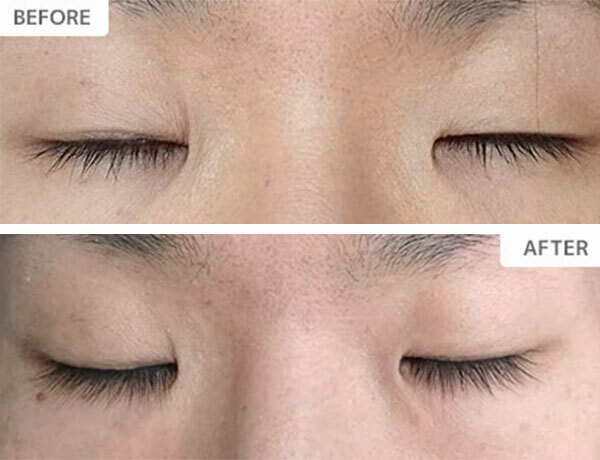 XXLashes まつげ美容液3ml