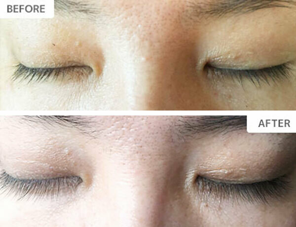 XXLashes まつげ美容液3ml