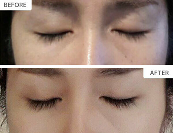 XXLashes まつげ美容液3ml