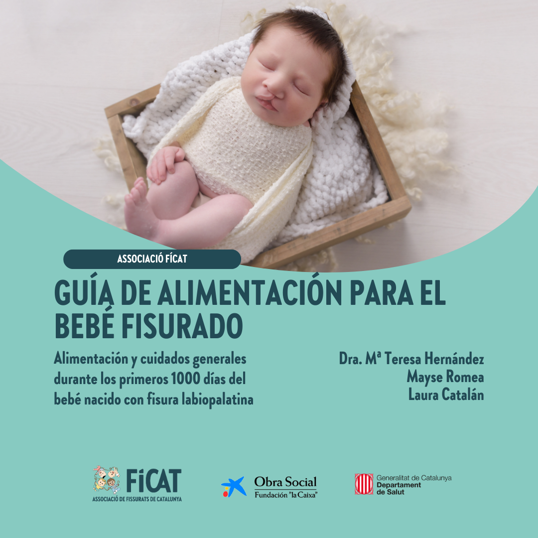 Guia d'alimentació per al nadó fissurat (castellà)