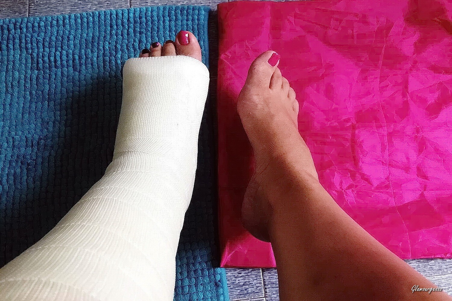 Polina Medical SLC - VIDEO 01: First week in medical cast
