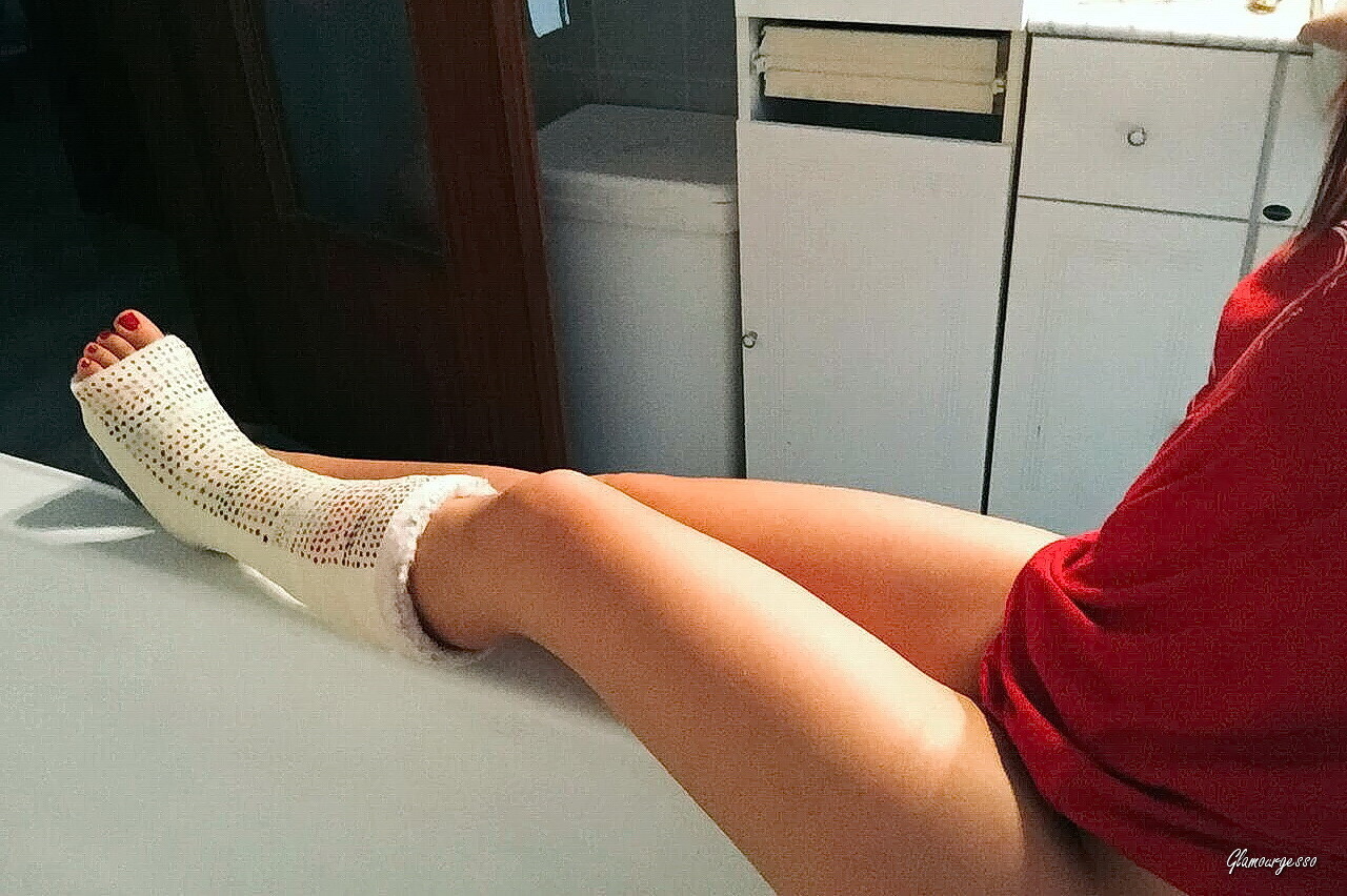 Polina Medical SLC - VIDEO 03: Third week in medical cast