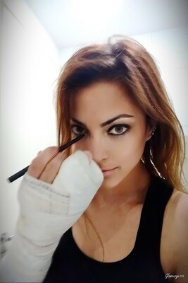 Raquel Medical SAFS - VIDEO 01: First week in cast