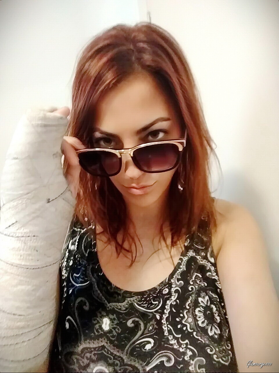 Raquel Medical SAFS - VIDEO 01: First week in cast
