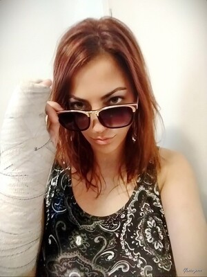 Raquel Medical SAFS - VIDEO 01: First week in cast