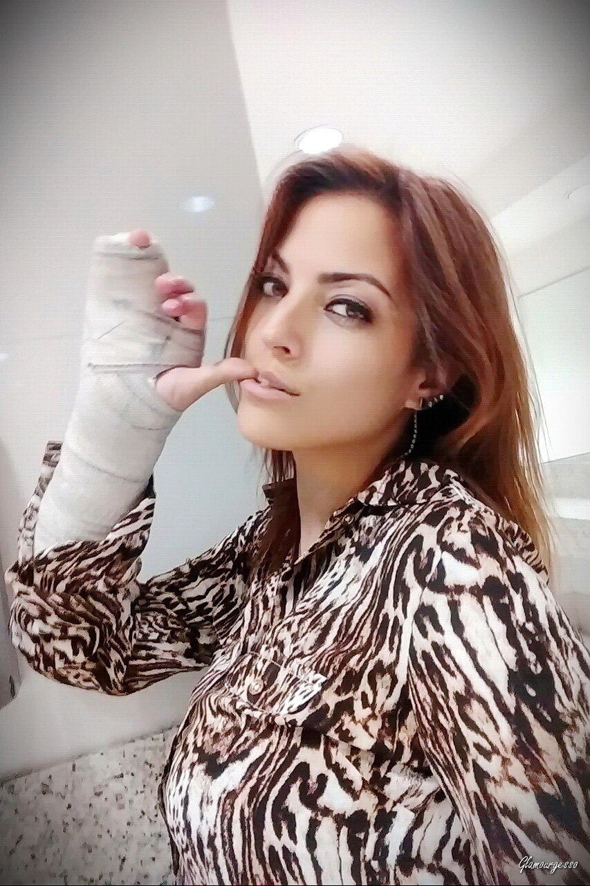 Raquel Medical SAFS - VIDEO 02: Second week in cast
