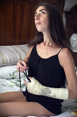 Penelope Medical SATS - VIDEO 01: Broken wrist dancer