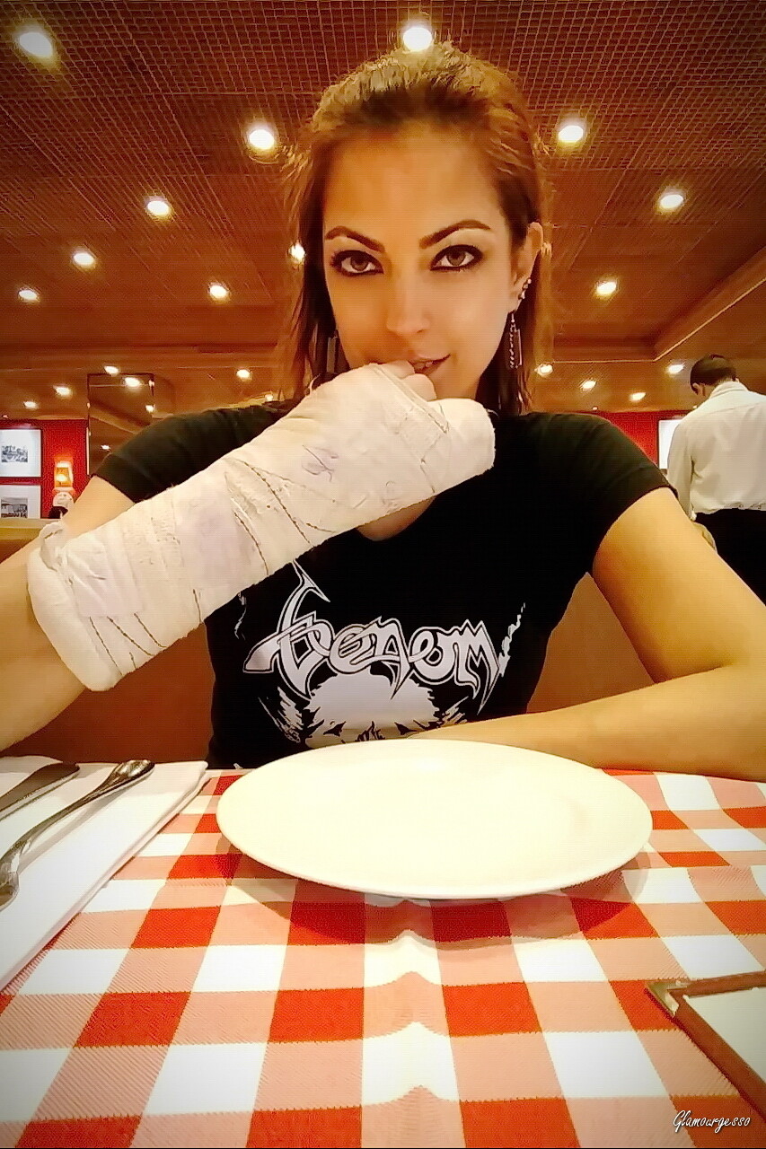 Raquel Medical SAFS - VIDEO 06: Third week in cast