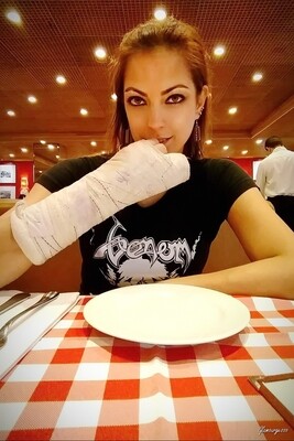Raquel Medical SAFS - VIDEO 06: Third week in cast