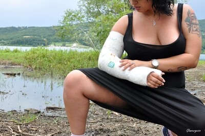 Erika LATS - VIDEO 01: Broken wrist brunette