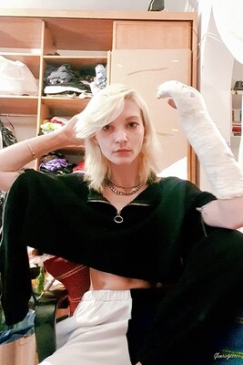 Ronnie Medical SAFS - VIDEO 03: Third week in cast