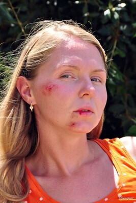 Svitlana LLC+SLC - VIDEO 01: Out from the hospital