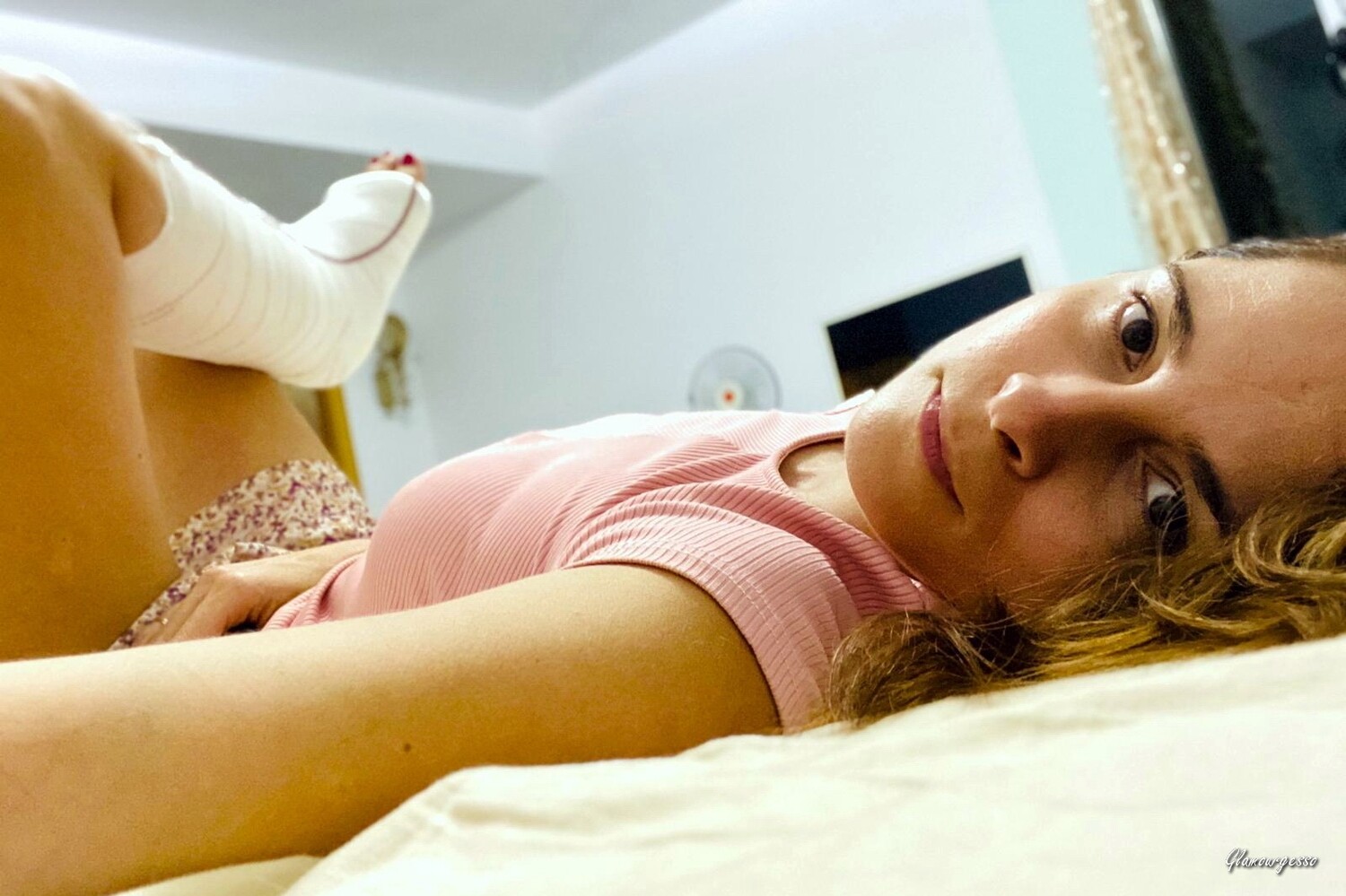 Indra Medical SLC - VIDEO 03: Sporty legs on crutches