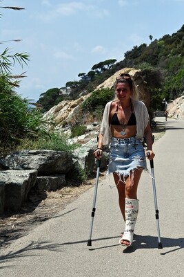 Alice Medical SLC - VIDEO 03: Rock climbing in cast