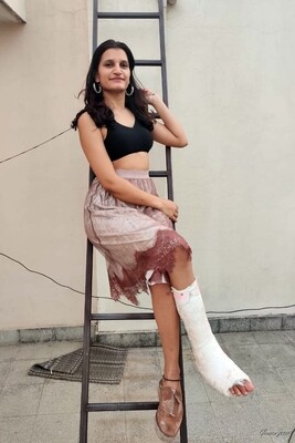 Sameera Medical SLC - VIDEO 02: 11 to 20 days in cast